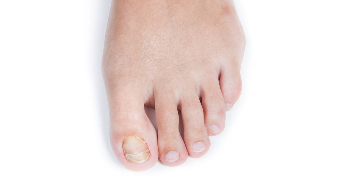 Dealing with thick, discolored toenails