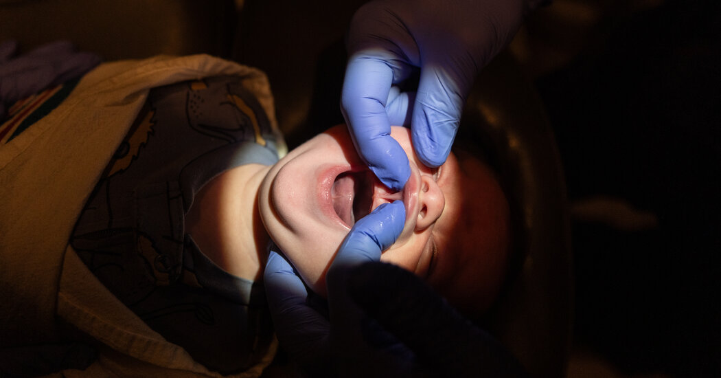 How Tongue Tie and Lip Tie Surgery Became a Big Business