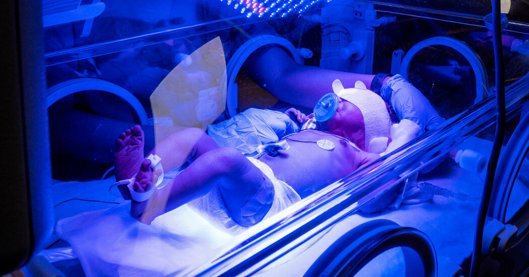 Did Your Baby Spend Time in the NICU? Tell Us About It.